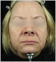 Buy Advanced Anti-Aging Vitamin C Serum Online